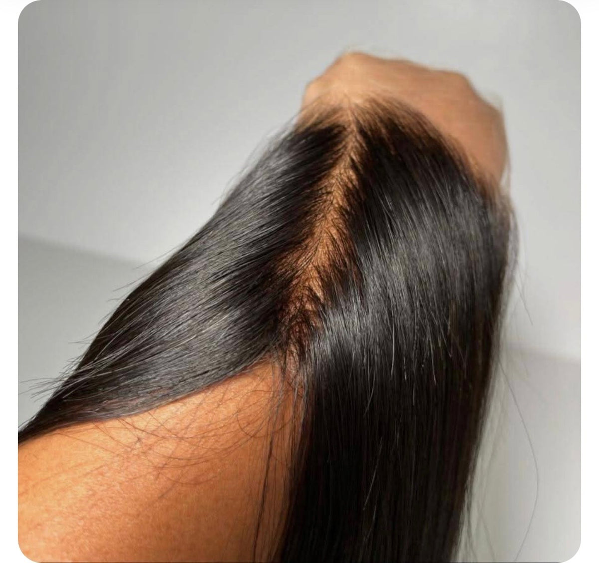 Frontals