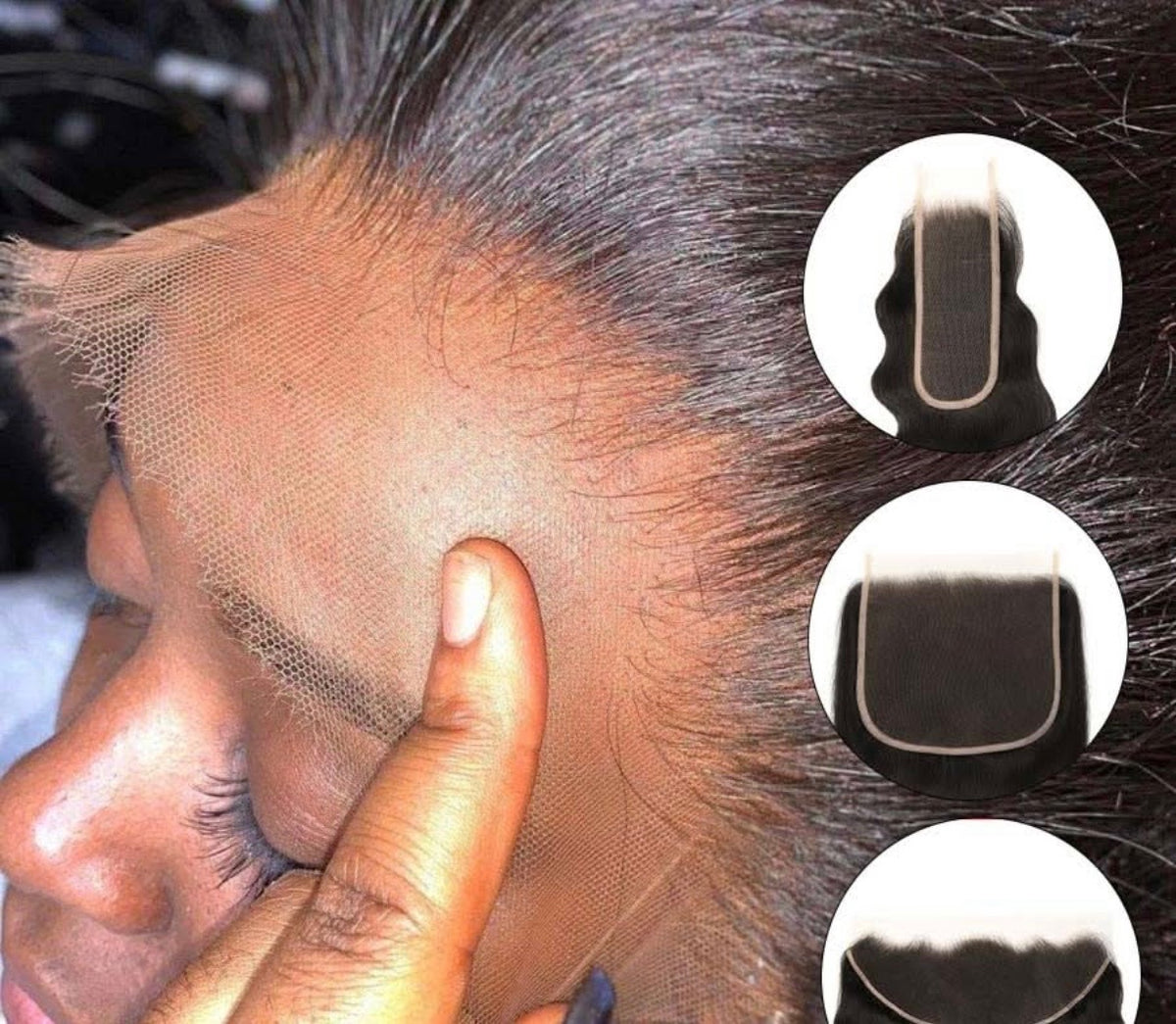 Frontals
